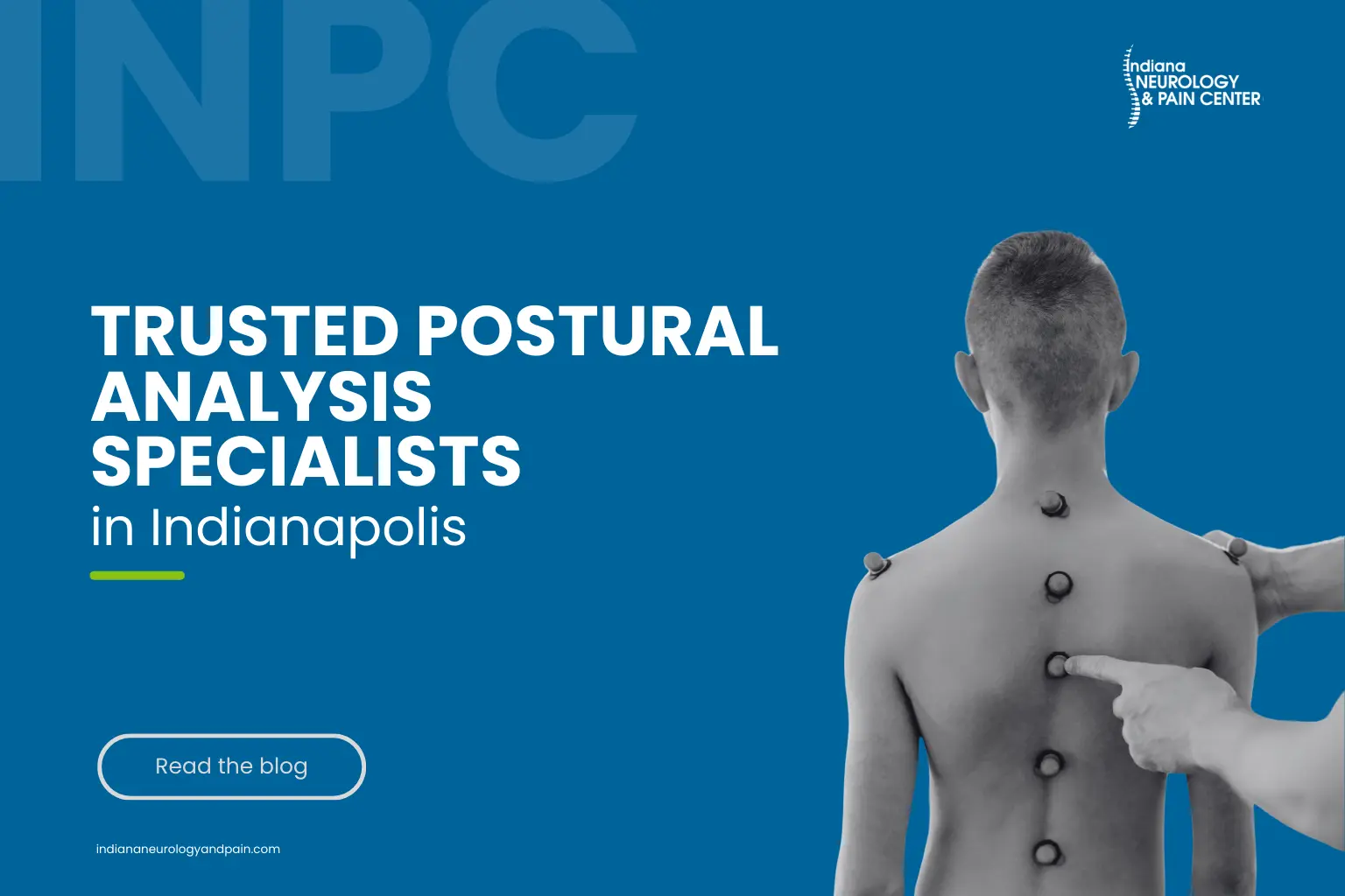 Read more about the article Trusted Postural Analysis Specialists in Indianapolis