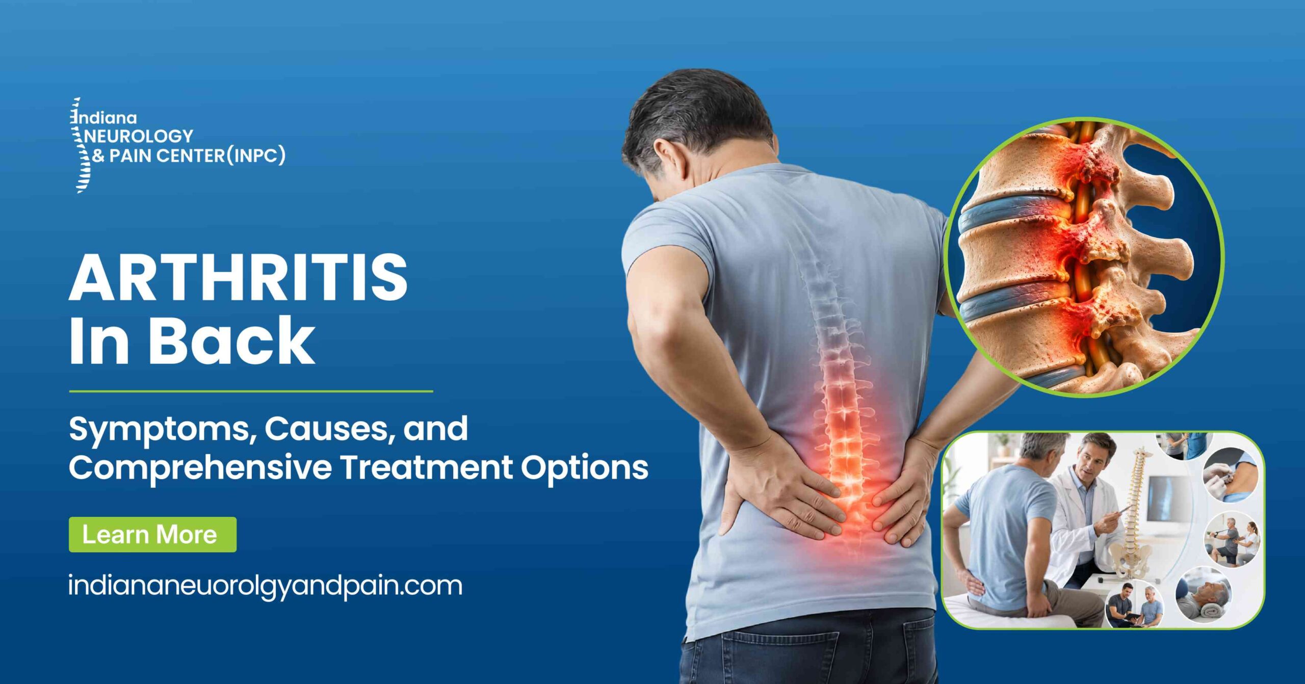 Arthritis in Back