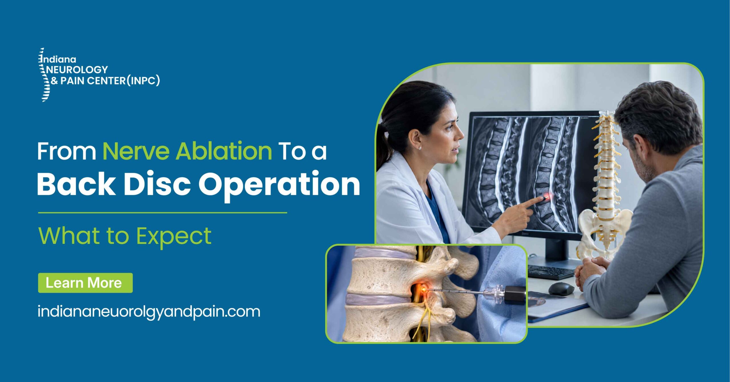 Read more about the article From Nerve Ablation to a Back Disc Operation: What to Expect