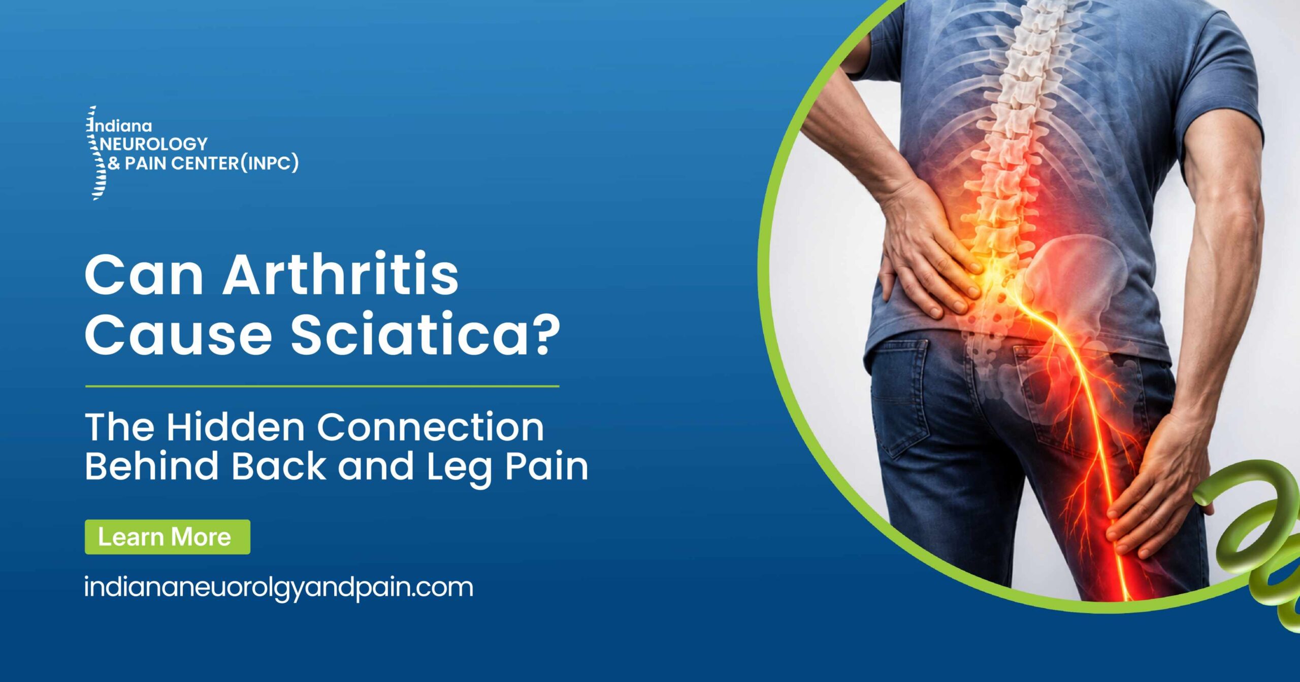 Can Arthritis Cause Sciatica