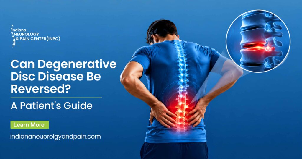 Can Degenerative Disc Disease Be Reversed