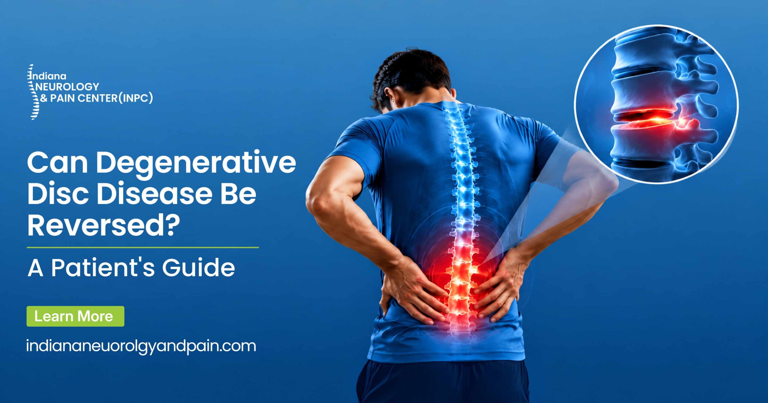 Can Degenerative Disc Disease Be Reversed